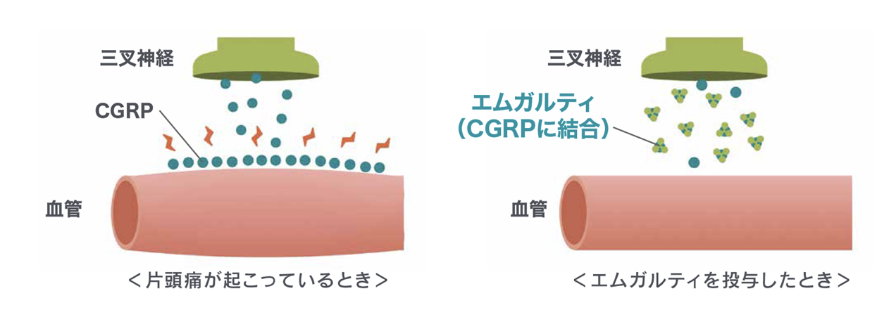 エムガルティの効果